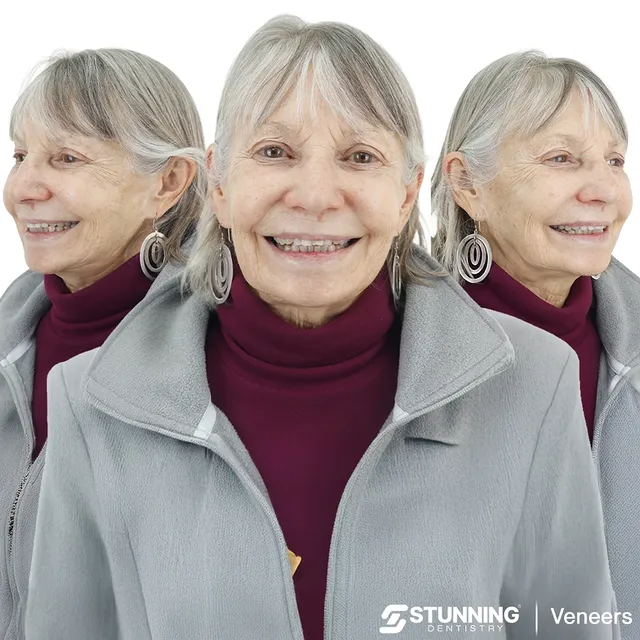 Smile Makeover, USA - photo 1